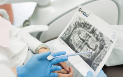 Ортопед (протезування зубів) у Кременчуці